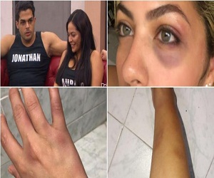 Acusado de golpear a su expareja, Ganador de ‘reality’