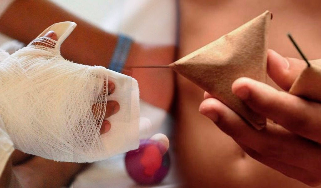 En lo corrido del mes de diciembre 371 personas lesionadas con pólvora