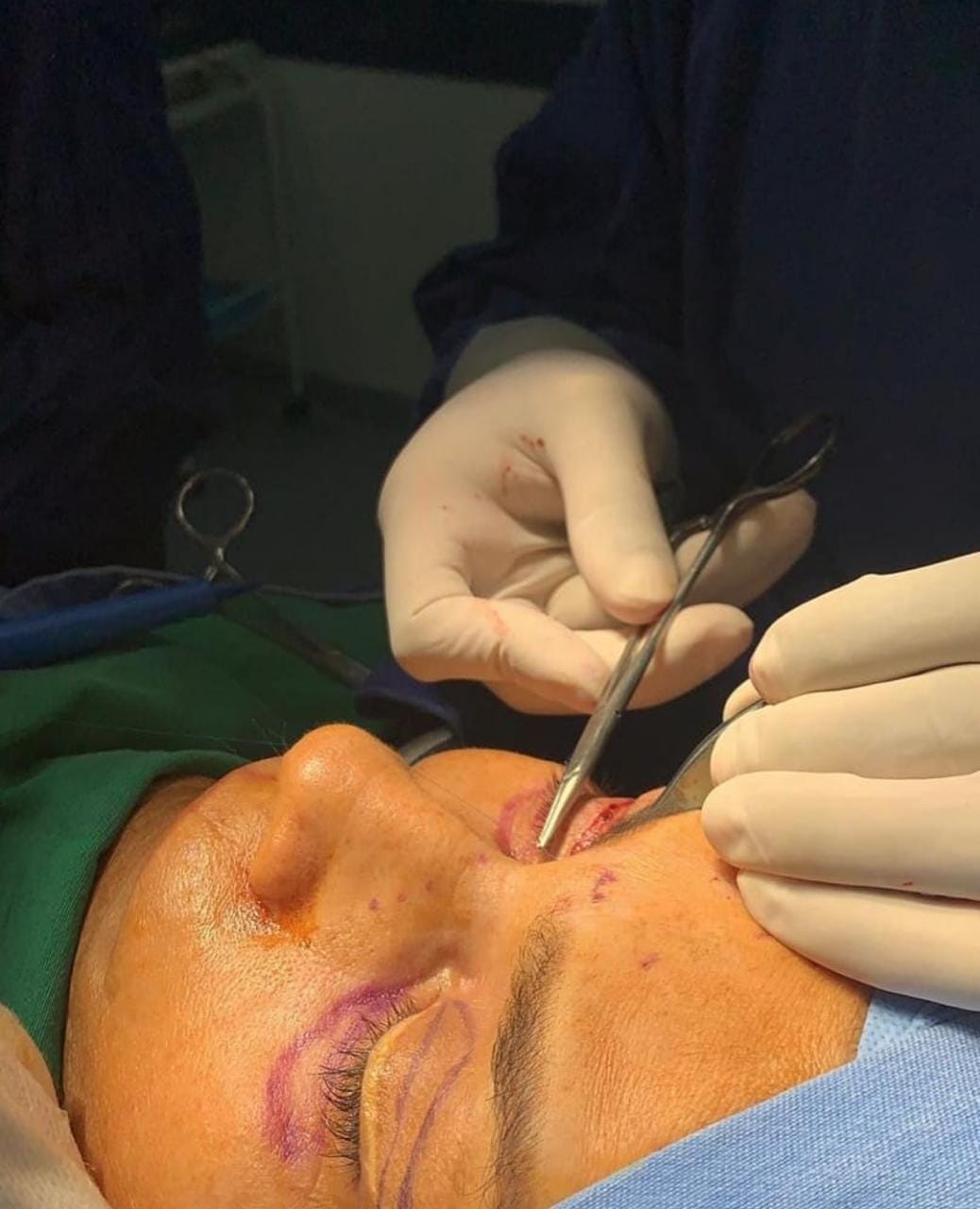 COLOMBIA PAIS REFERENTE EN EL TURISMO DE CIRUGIAS PLASTICAS