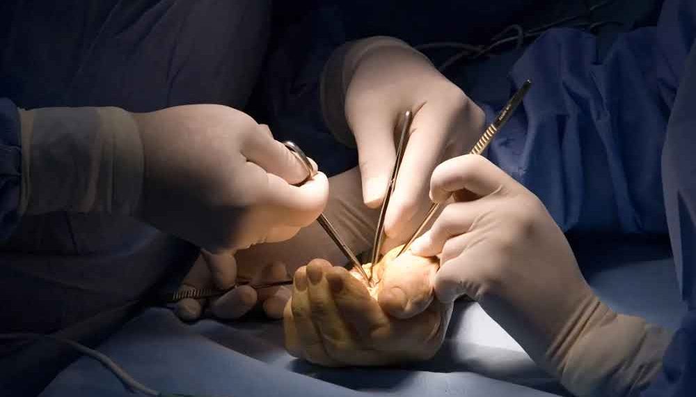 Confunden cirugías y realizan vasectomía en lugar de extracción de vesícula